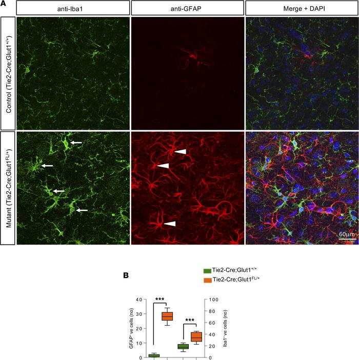 Selective loss of Glut1 in ECs evokes cerebral neuroinflammation.
(A) Re...