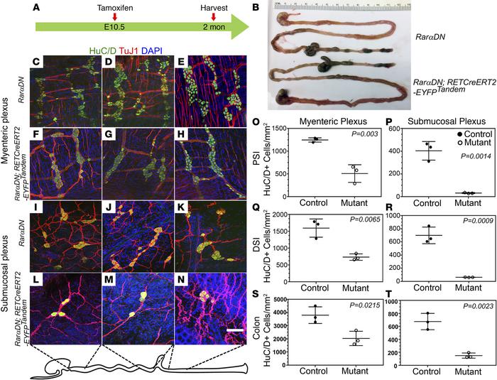 Postnatal ENS phenotype when RAR signaling is inactivated in Ret lineage...