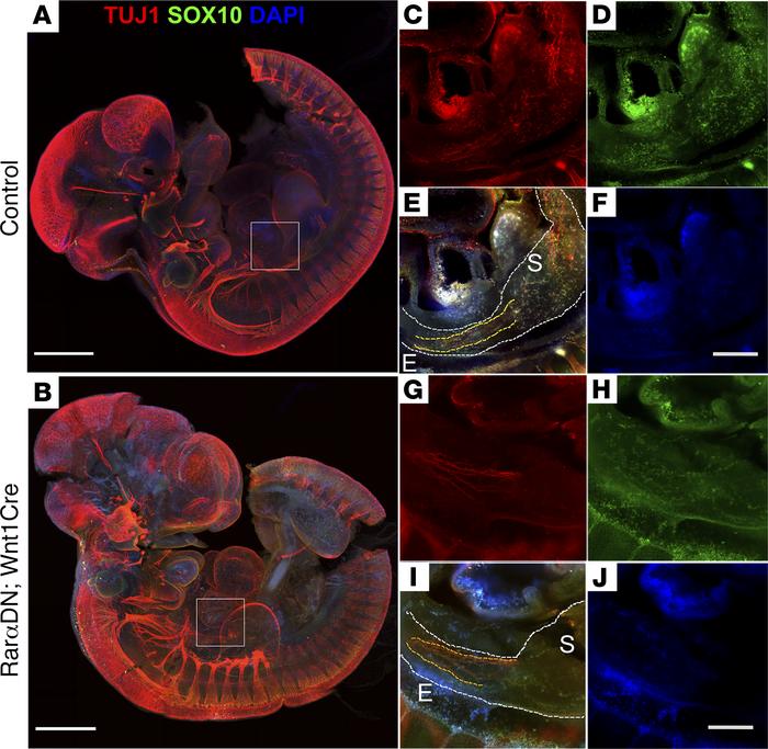 Blocking RAR signaling impairs ENCDC migration and differentiation at E1...