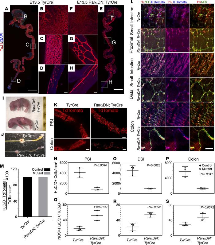 TyrCre-driven RarαDN reduces enteric neuron number and causes abnormal E...
