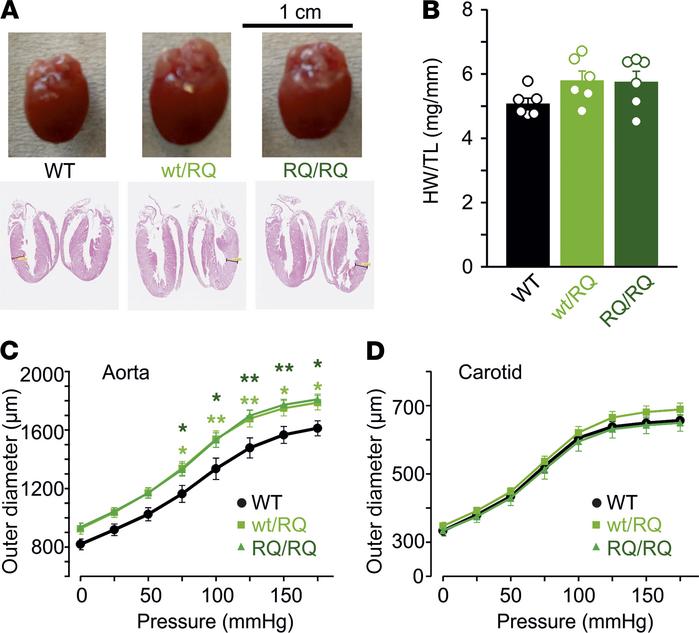 Cardiovascular phenotype of R1154Q mice.
(A and B) Cardiomegaly in heter...