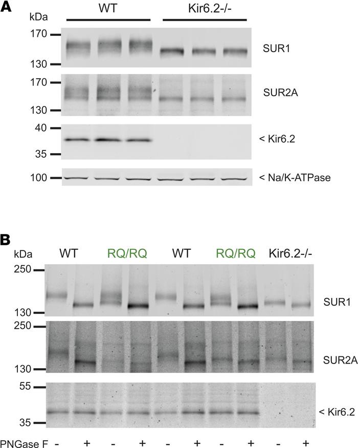 SUR1 and SUR2A maturation in SUR2A[R1154Q] hearts.
(A) Western blot anal...