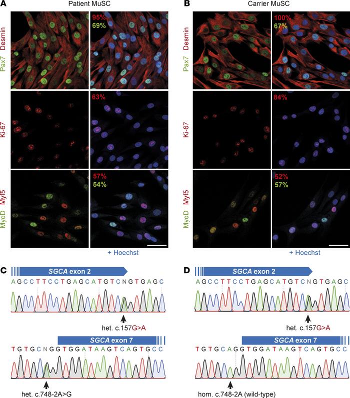 Characterization of primary MuSC from 2 donors with a heterozygous SGCA ...
