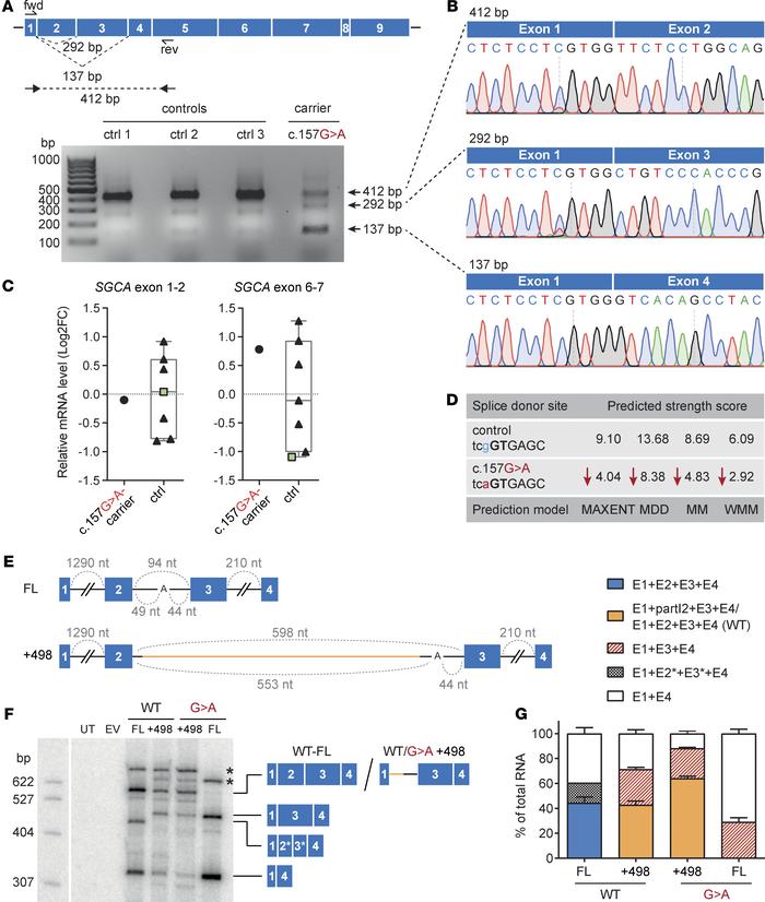 
SGCA c.157G&gt;A is an exonic splicing mutation.
(A) RT-PCR analysis of...