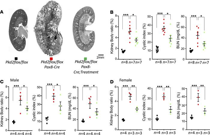 Effect of the dopamine receptor antagonist SCH2339 on renal cysts progre...