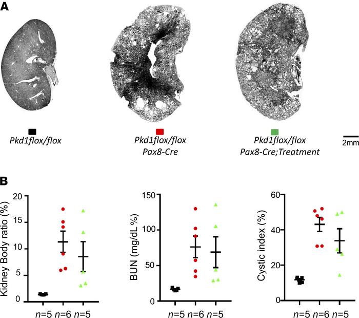 Effect of the dopamine receptor antagonist SCH2339 on renal cysts progre...