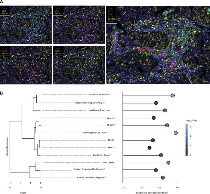 SLFN11 is expressed in a subset of immune-related cells and is associate...