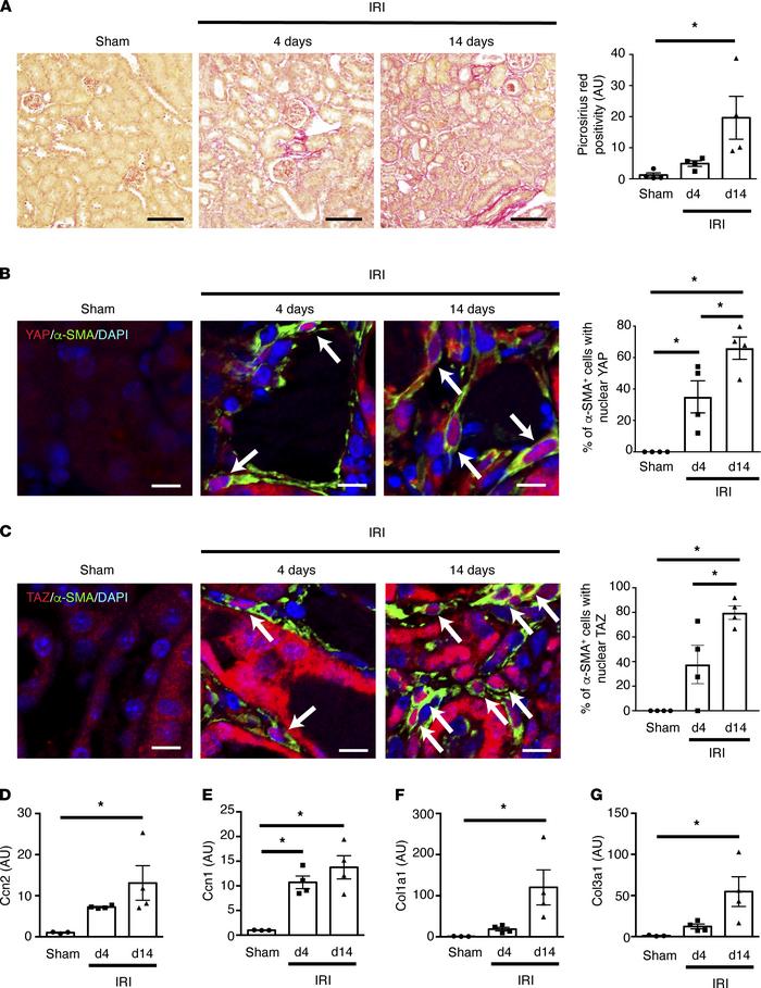 Myofibroblast YAP and TAZ are progressively activated during renal fibro...