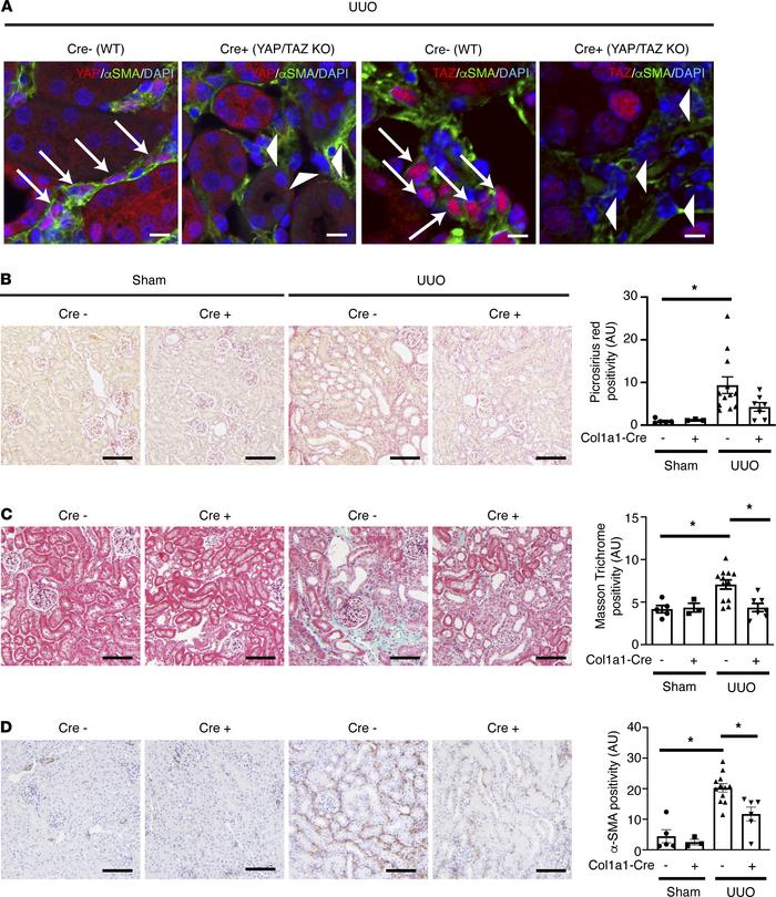 Myofibroblast-specific YAP/TAZ deficiency attenuates unilateral ureteral...