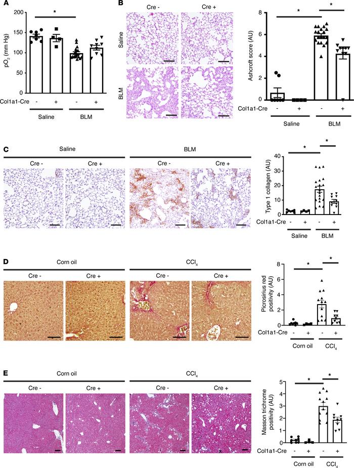 Myofibroblast-specific YAP/TAZ deficiency attenuates bleomycin-induced l...