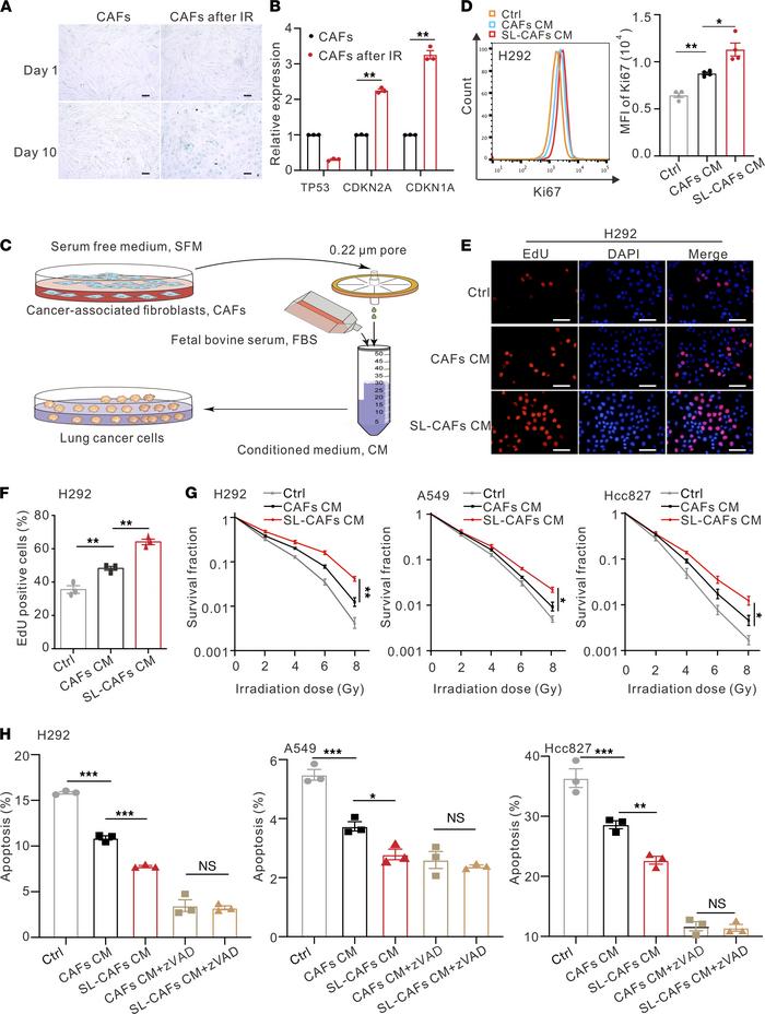 Effects of SL-CAFs on NSCLC cells in vitro.
(A) Cell senescence detected...