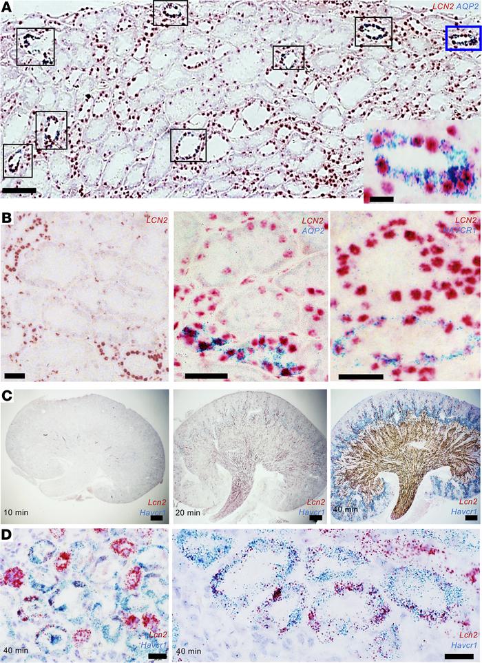 Patterning of gene expression.
(A) Human kidney biopsy. Mild ATI due to ...