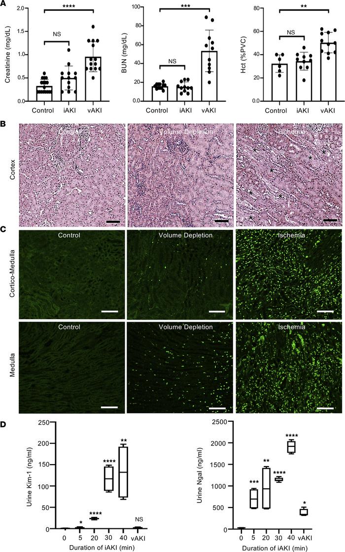 Models of different forms of azotemia.
(A) Ischemic injury of the kidney...