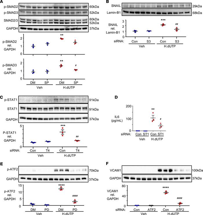 JNK/SMAD3 is required to induce SNAIL, TLR4-mediated STAT1 signaling is ...