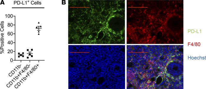 The majority of the PD-L1+ cells within the TME are TAMs.
(A) Percentage...
