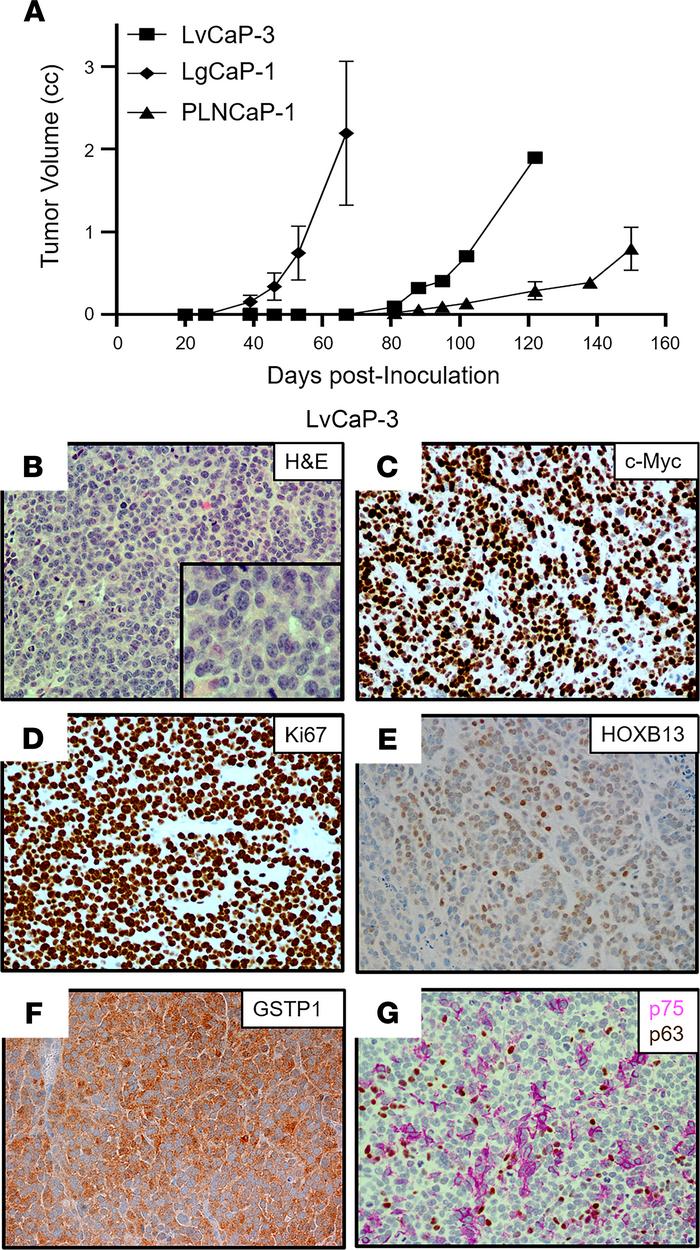 Characteristics of the LvCaP-3 PDX.
(A) Comparative growth rate in castr...