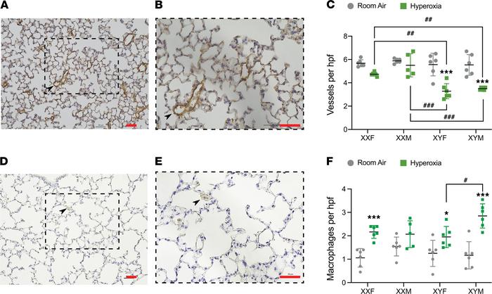 Arrest in angiogenesis and lung macrophages after hyperoxia exposure is ...