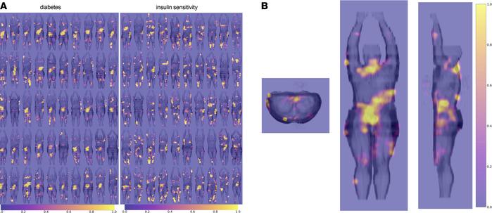Gradient maps visualizing voxels with large influence on the classificat...
