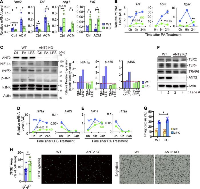 ANT2 is necessary for the metabolic activation of macrophages.
(A) mRNA ...