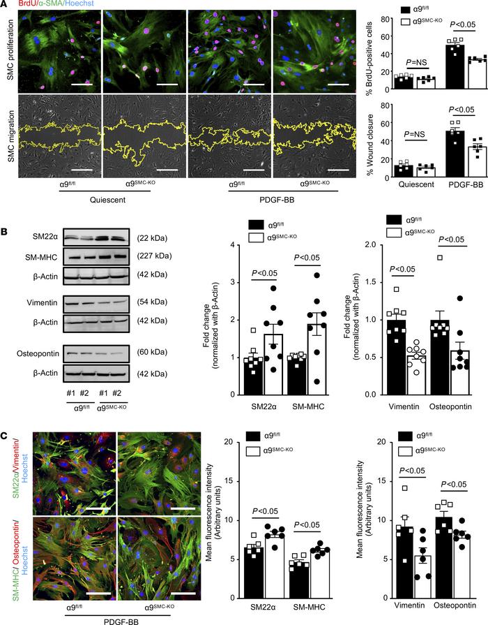 SMC-specific α9 deletion suppresses PDGF-BB–induced SMC proliferation, m...