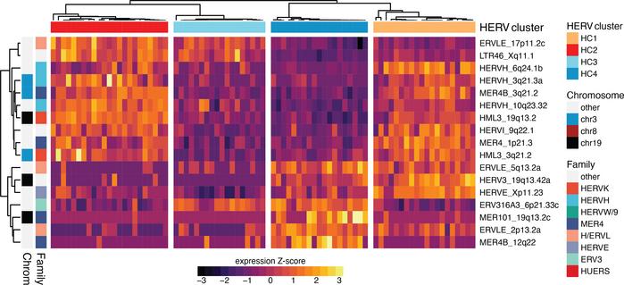 HERV expression signature distinguishes UM subsets.
Heatmap showing HERV...