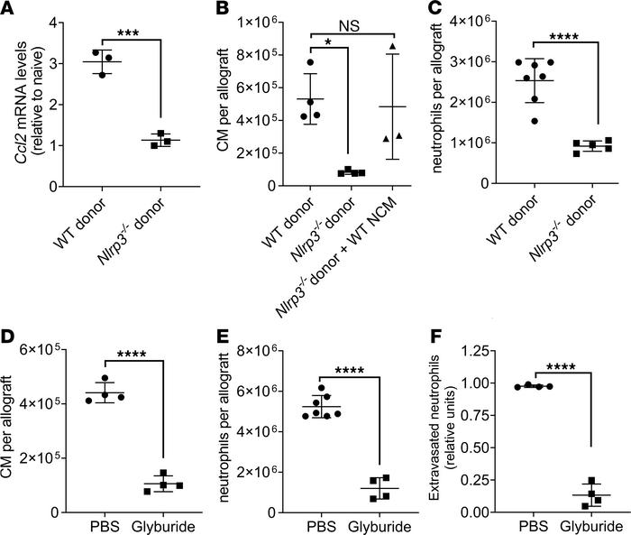 Nonclassical monocytes (NCM) produce IL-1β via NLRP3 inflammasome activa...