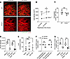 Depletion of donor nonclassical monocytes (NCM) suppresses the recruitment