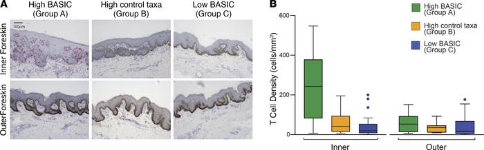 High BASIC species abundance is associated with T cell recruitment to on...