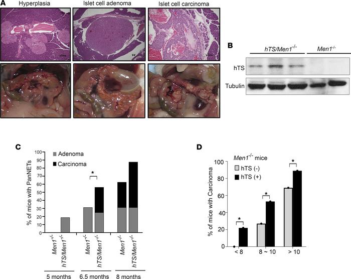 Overexpression of hTS accelerates PanNET progression in mice with condit...