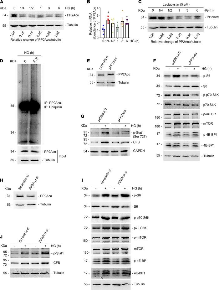 PP2Acα deficiency mediates high glucose–induced mTORC1 activation and CF...