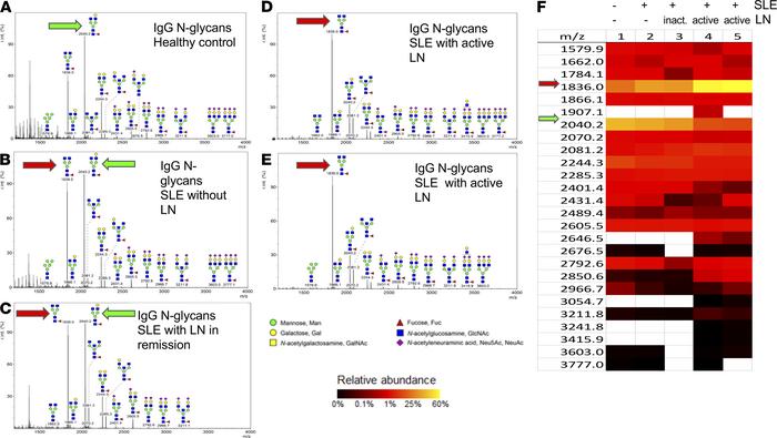 IgG from individuals with active LN is undergalactosylated compared with...