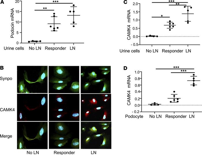 CaMK4 expression in urine podocytes identifies individuals with active L...