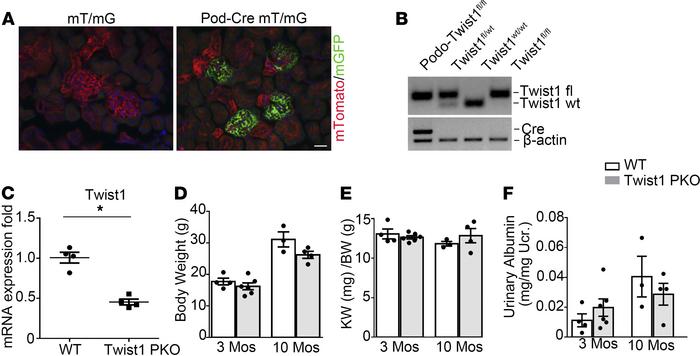 Mice with podocyte-specific ablation of Twist1 are healthy.
(A) Represen...