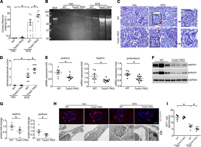 Twist1 in podocytes limits albuminuria and podocyte injury induced by NT...