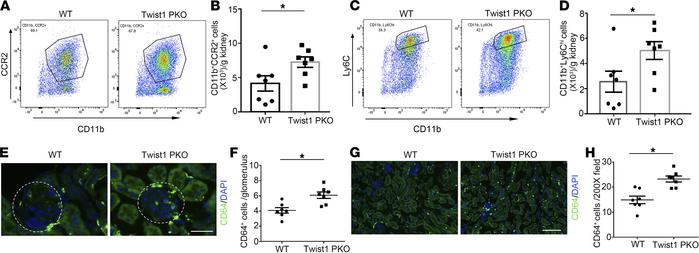 Twist1 in podocytes suppresses macrophage accumulation in glomeruli and ...