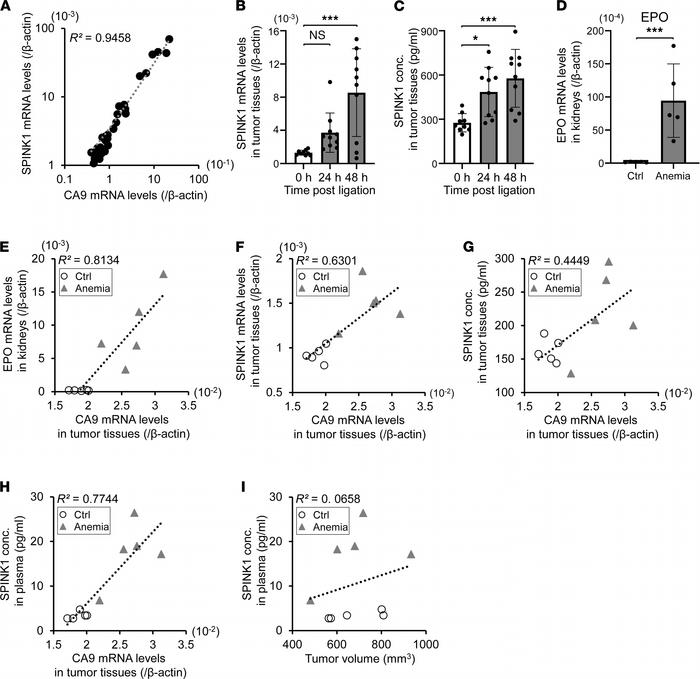 SPINK1 in plasma reflects the degree of hypoxia within tumor tissue in v...