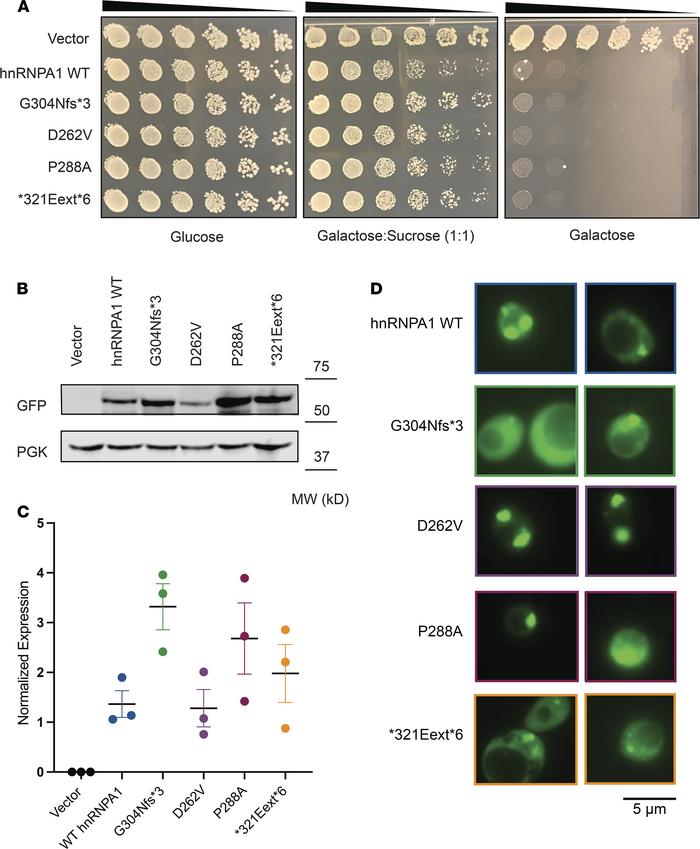 hnRNPA1 variants are toxic and aggregate in yeast.
(A) GFP-tagged hnRNPA...