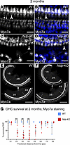 OHC loss in Ndp-KO cochlea.