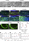 Marginal cell morphology and permeability of vascular barrier in Ndp-KO str
