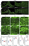 Postnatal onset of morphological abnormalities in stria vascularis capillar