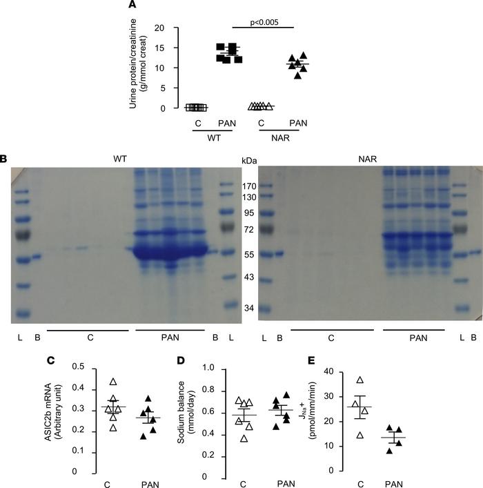 Role of albumin in ASIC2b expression and sodium retention.
(A) PAN-induc...