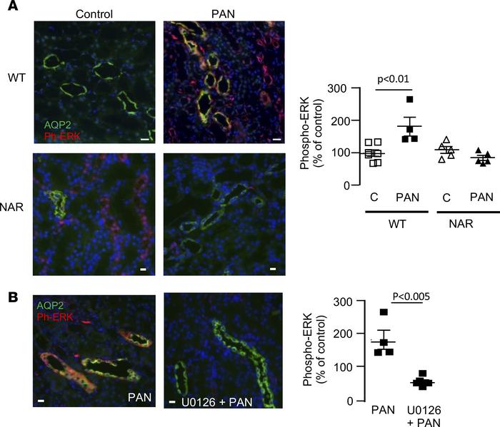 ERK pathway is triggered by luminal albumin.
(A) Immunolabeling of kidne...