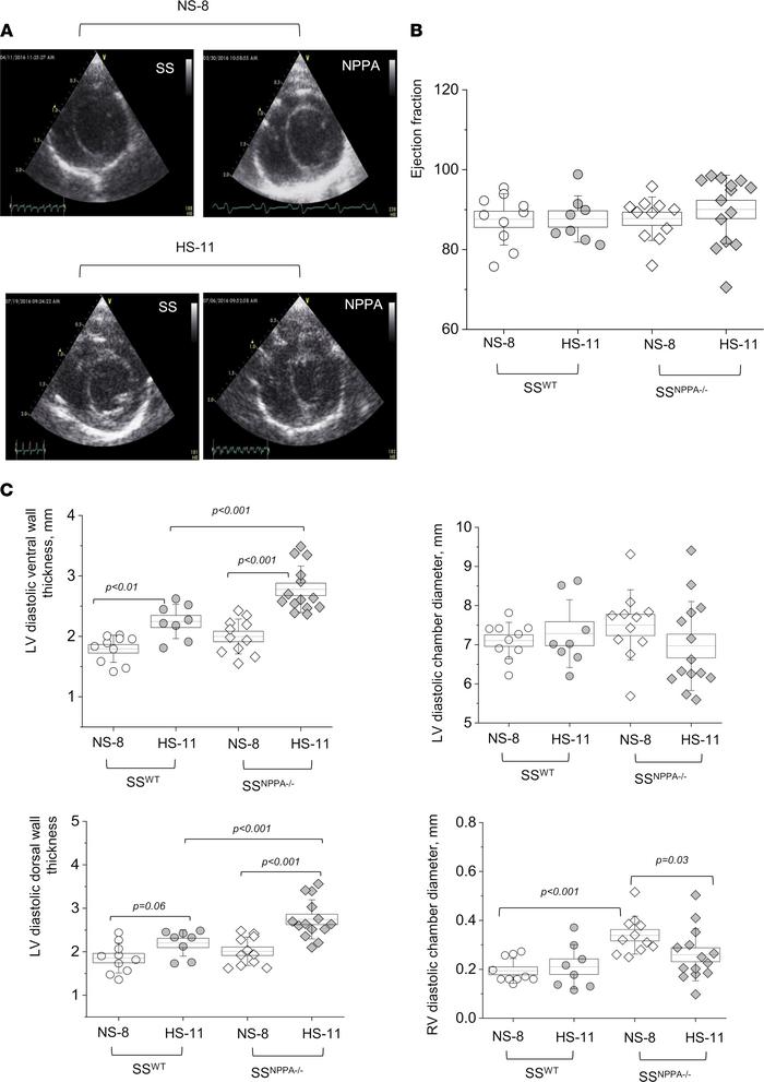 Echocardiography demonstrates preserved ejection fraction and fractional...