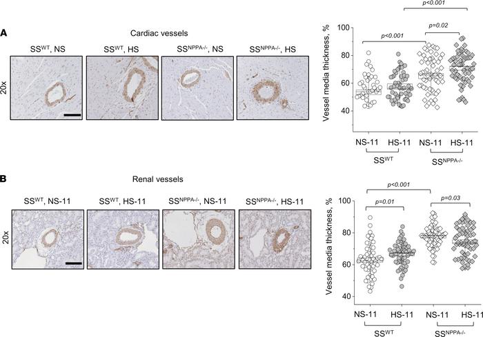 Male SSNPPA–/– rats show more pronounced renal and cardiac vessel media ...