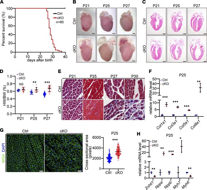 Deletion of Znhit1 caused premature sudden death and pathological cardio...