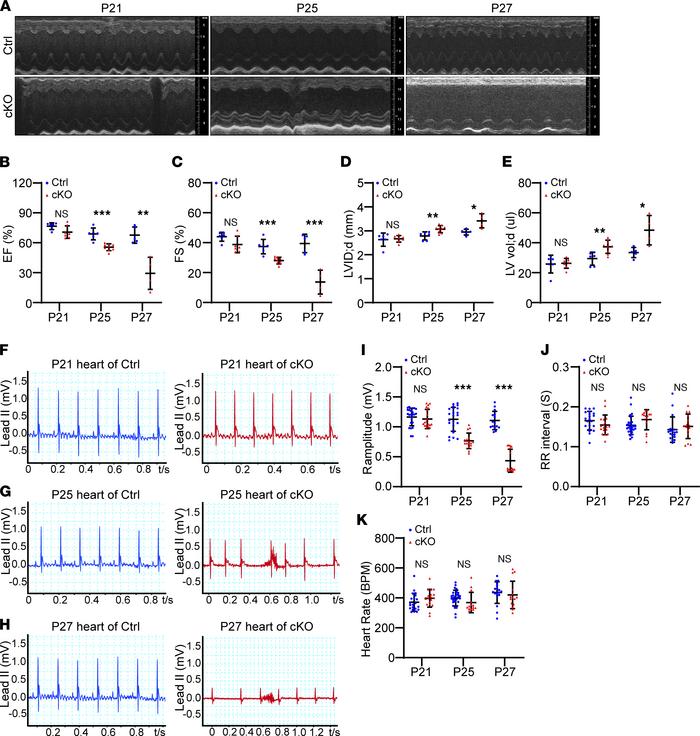 Znhit1 cKO mice had rapid heart failure and arrhythmia.
(A) Representati...