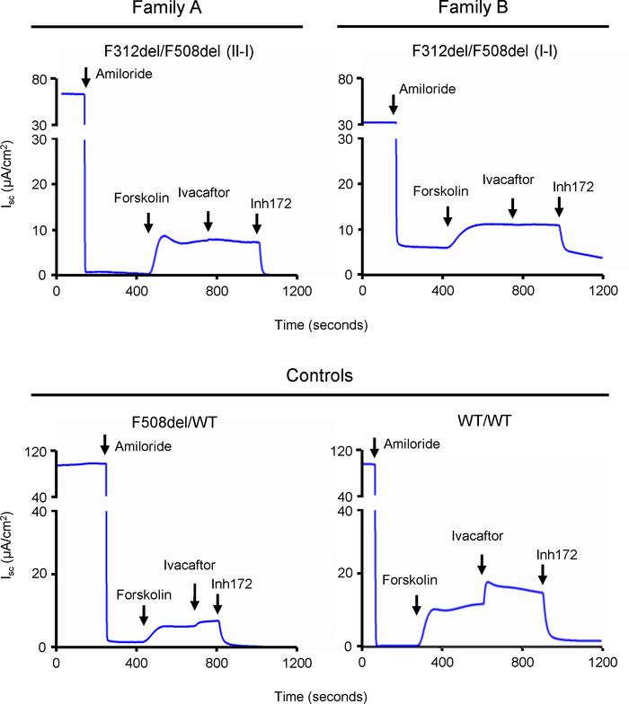 Ivacaftor does not potentiate function of CFTR bearing F312del in well-d...