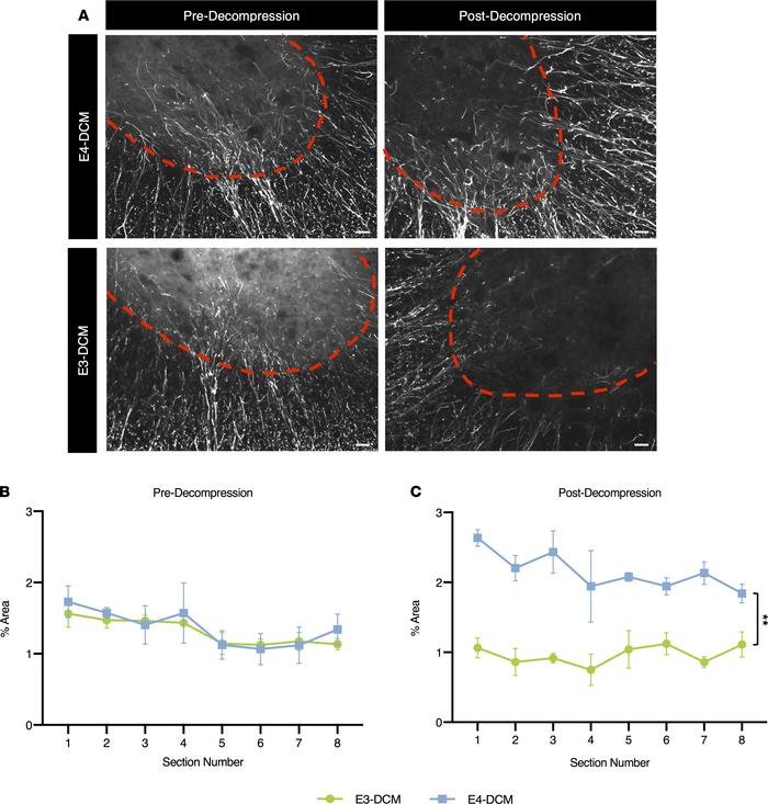Increased astrogliosis in human ApoE4–knockin mice 24 hours after decomp...