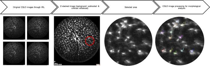 CSLO image processing for the morphological analysis of innate immune ce...