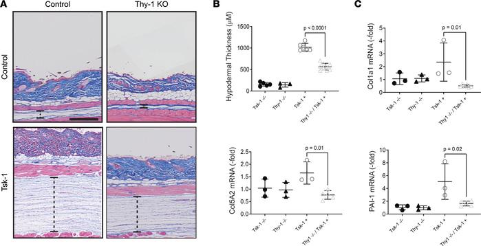 Tsk-1 mice lacking Thy-1 have attenuated skin fibrosis.
(A) Representati...